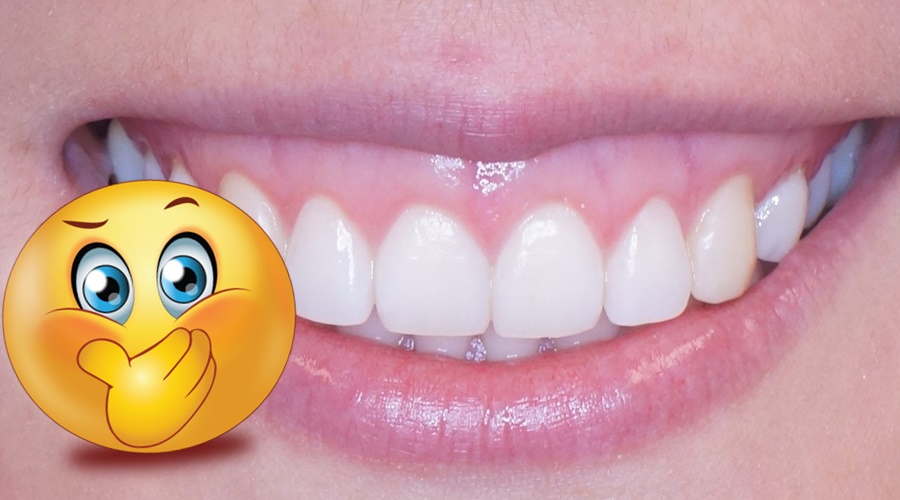 Los beneficios que te dejan con una sonrisa